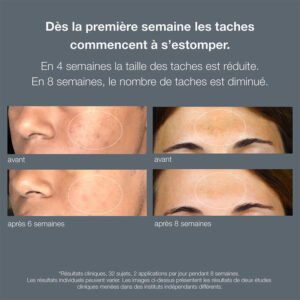 PowerBright Dark Spot Serum 30ml – Sérum Anti-taches & Éclat