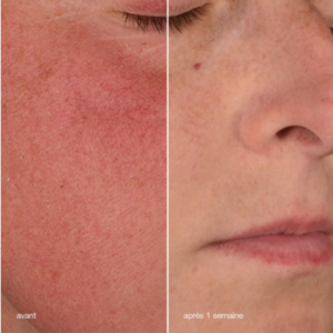 Dermalogica Stabilizing Repair Cream 50ml – Crème réparatrice apaisante pour peau sensible